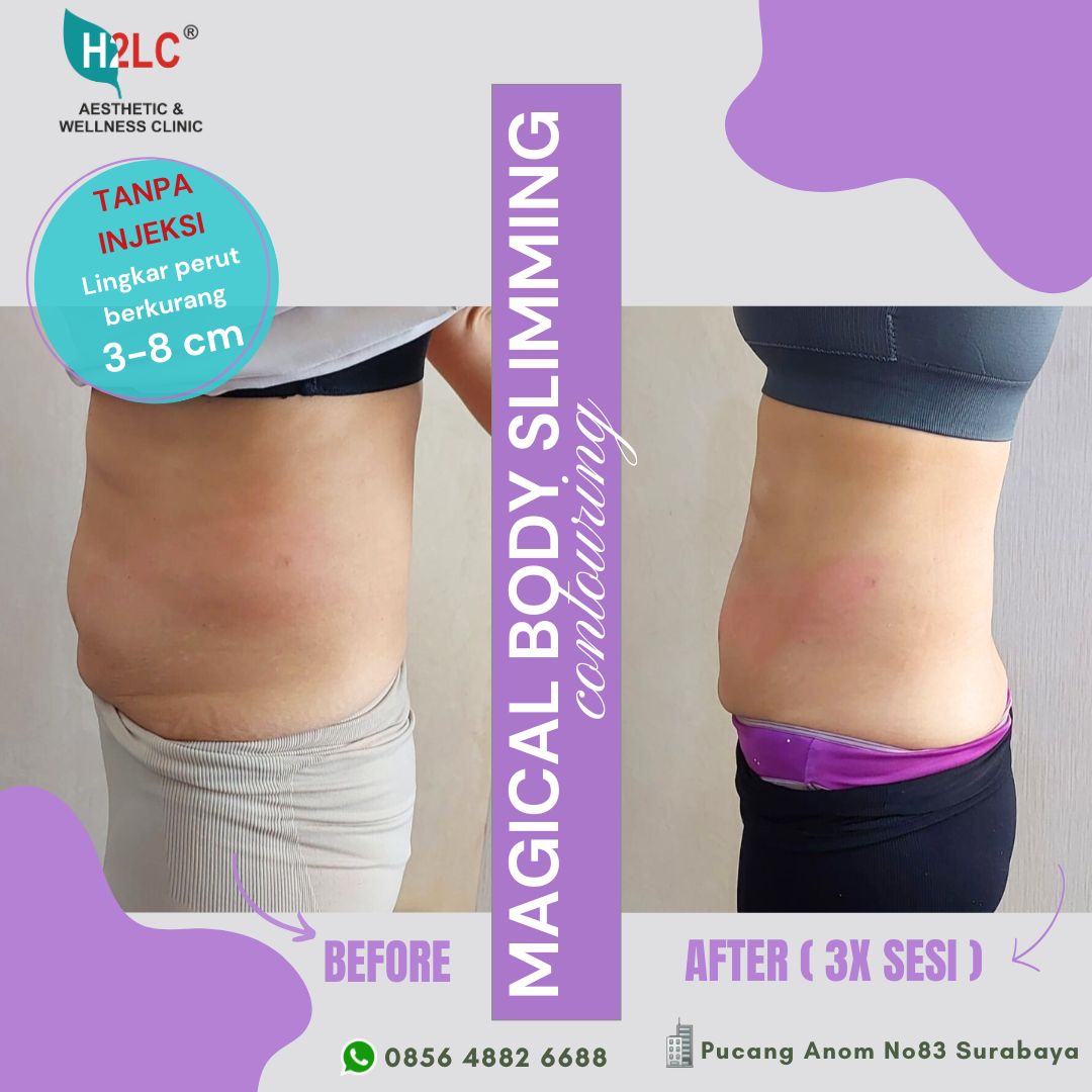 Hasil Magic Slim Korea Body